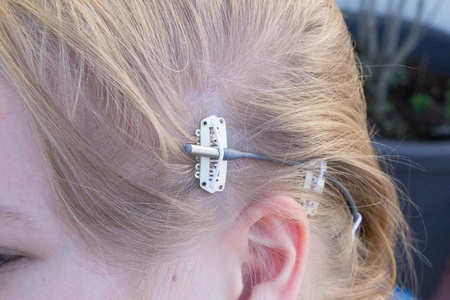 HIDE-A-MIC CLIPZ - White